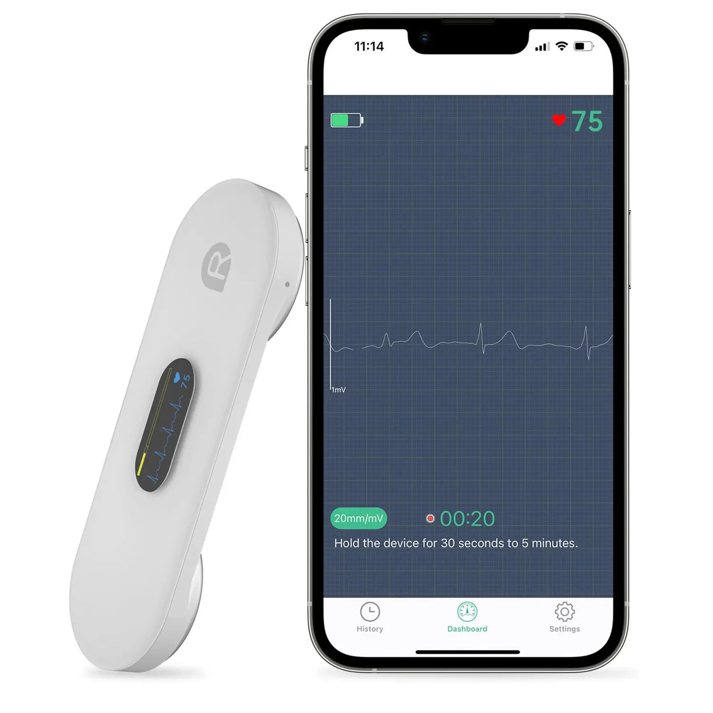 Moniteur ECG portatif DuoEK