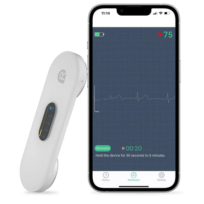 Moniteur ECG portatif DuoEK