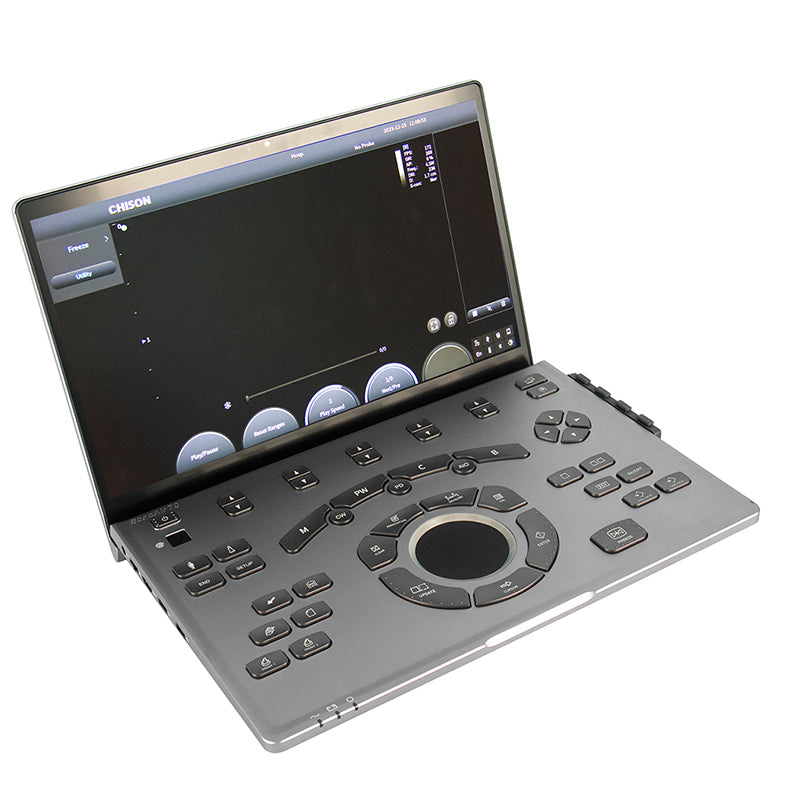 Échographe Doppler Couleur Portable CHISON SonoBook 7 avec Sonde Cardiaque P2-V 2.5 MHz