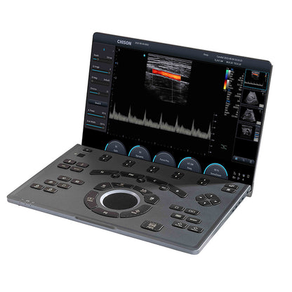 Échographe Doppler Couleur Portable CHISON SonoBook 7 avec Sonde Cardiaque P2-V 2.5 MHz