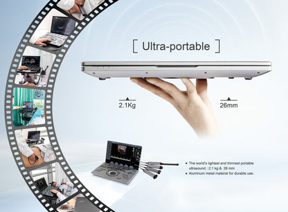 Échographe Doppler Couleur Portable CHISON SonoBook 7 avec Sonde Cardiaque P2-V 2.5 MHz