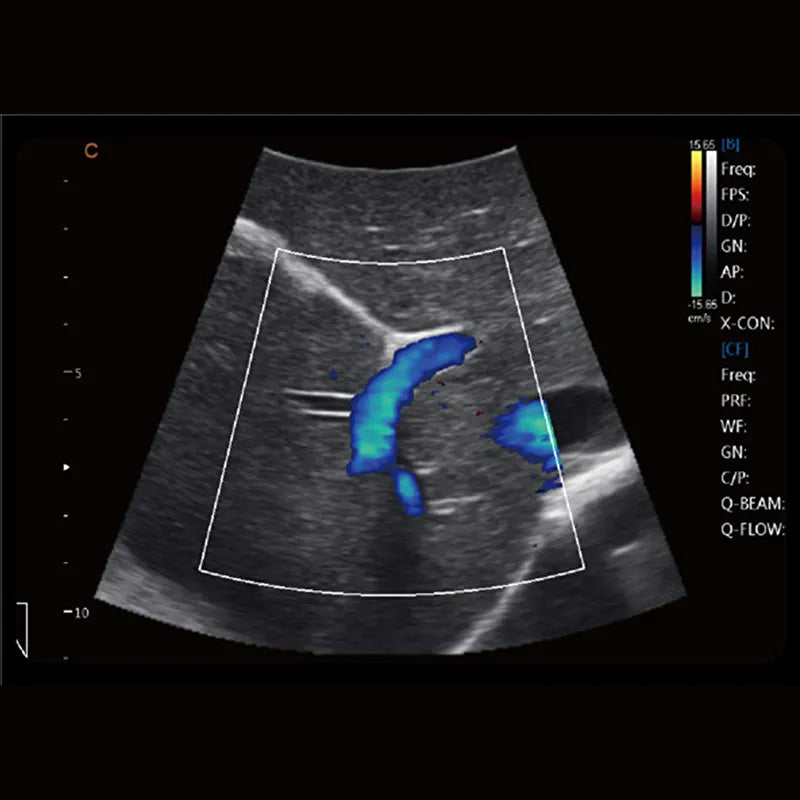 Échographe Doppler Couleur CHISON CBit 4 PRO avec 2 Sondes