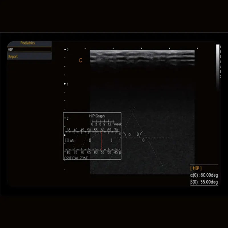 Échographe Doppler Couleur CHISON CBit 4 PRO avec 2 Sondes