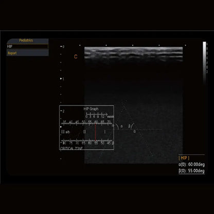 Échographe Doppler Couleur CHISON CBit 4 PRO avec 2 Sondes