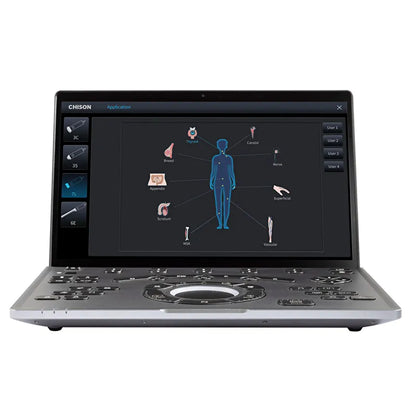 Échographe Portable CHISON SonoAir 30 avec 2 sondes et support mobile