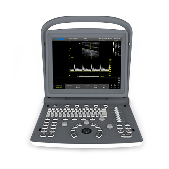 Chison - Echographe portable à ultrasons Portable ECO2