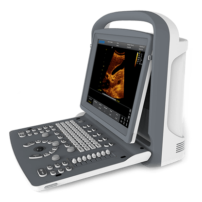 Chison - Echographe portable à ultrasons Portable ECO2