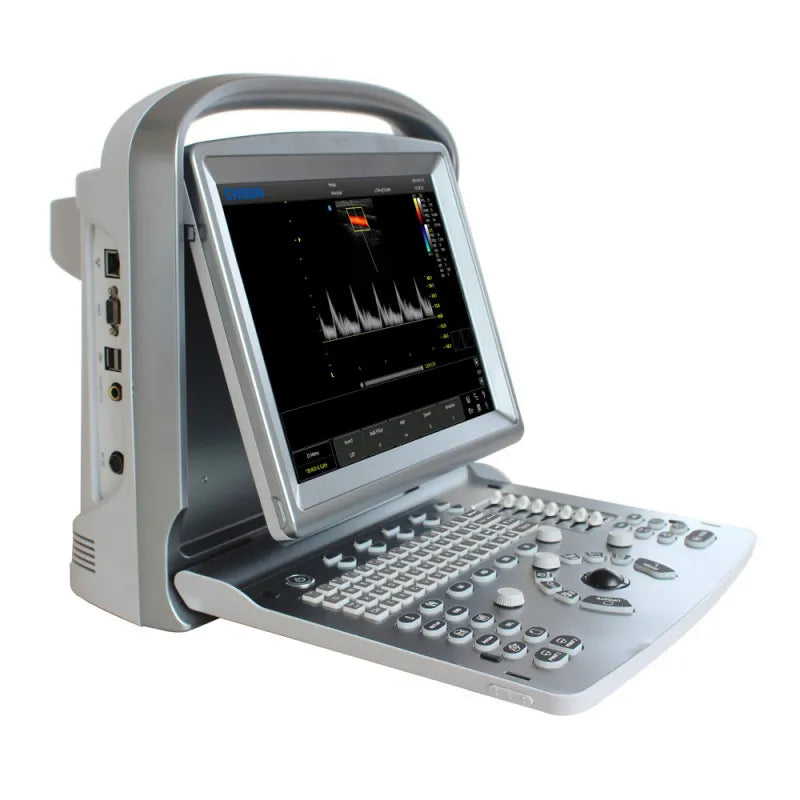 Échographe Portable CHISON ECO 5 avec sonde Convexe 3.5 MHz (C3-A)