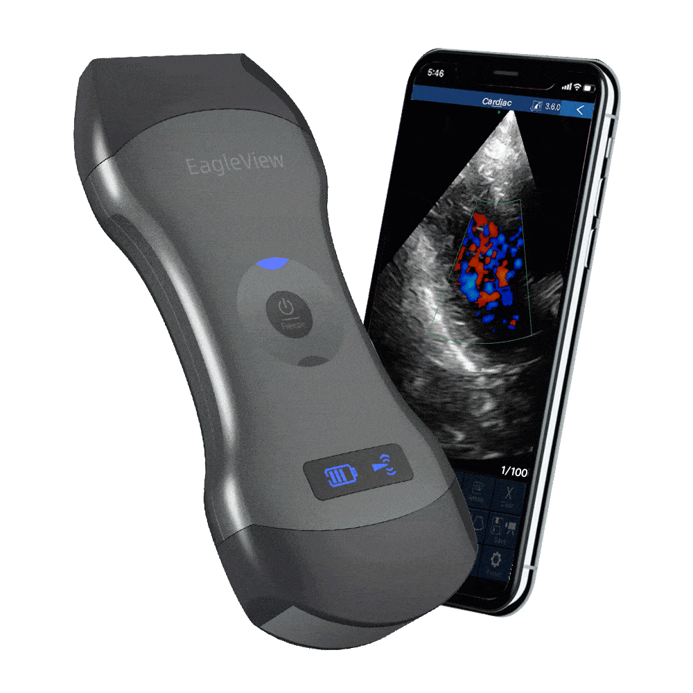 Echographe portatif sans fil à double tète US-2H