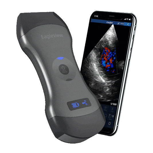 Echographe portatif sans fil à double tète US-2H