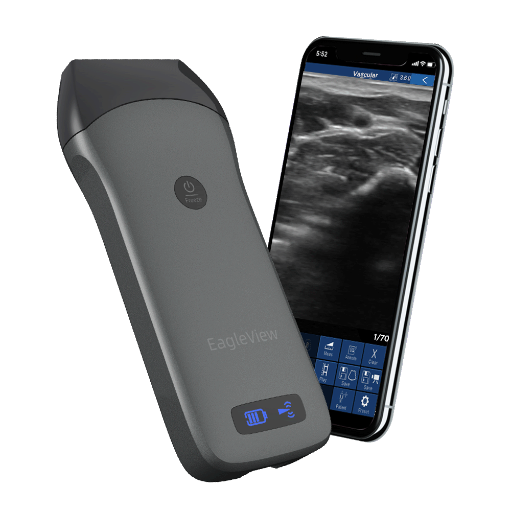 Échographe portatif sans fil linéaire - US-1H