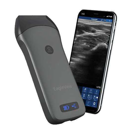 Échographe portatif sans fil linéaire - US-1H