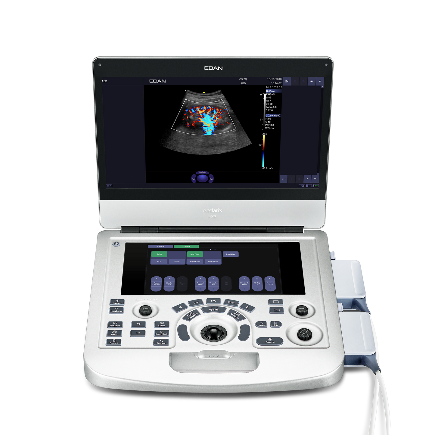 EDAN - Échographe Portable Acclarix AX3 – Système Ultrasons Compact Haute Performance