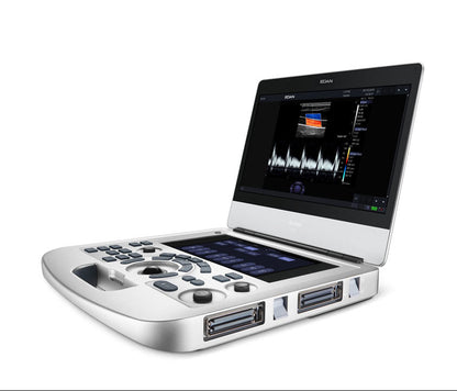 EDAN - Échographe Portable Acclarix AX3 – Système Ultrasons Compact Haute Performance