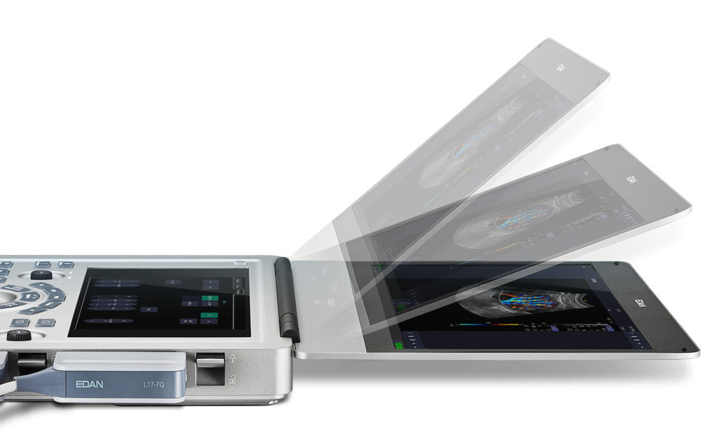 EDAN - Échographe Portable Acclarix AX3 – Système Ultrasons Compact Haute Performance
