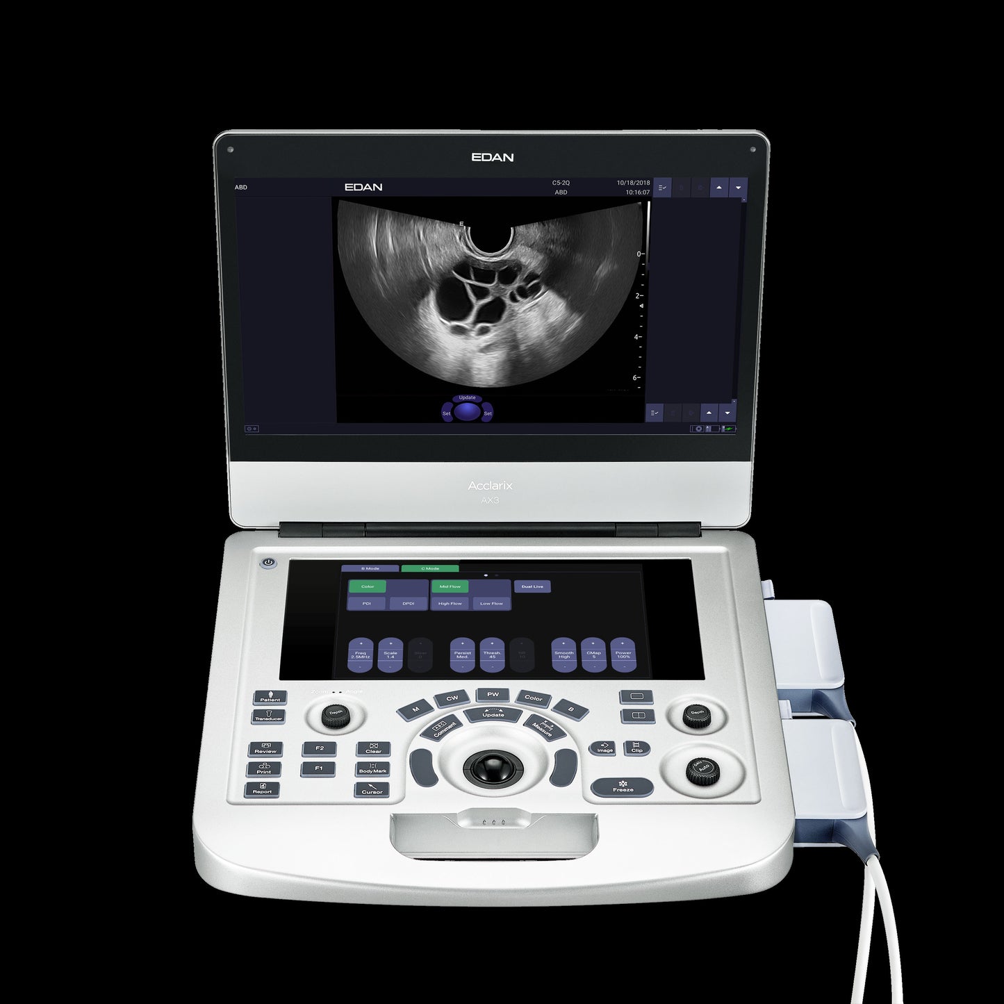 EDAN - Échographe Portable Acclarix AX3 – Système Ultrasons Compact Haute Performance