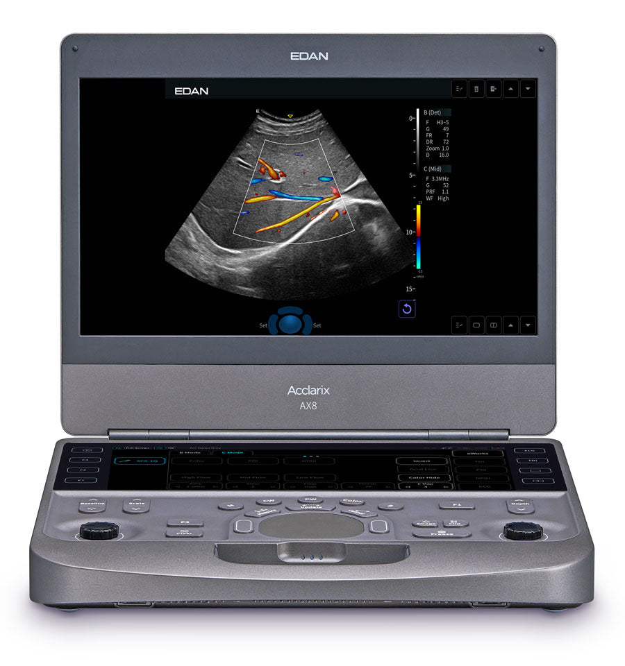 EDAN - Échographe Portable Acclarix AX8 – Système Ultrasons Compact Haute Performance
