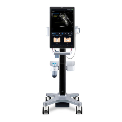 Acclarix GX9F – Système d’échographie intelligent pour l’obstétrique