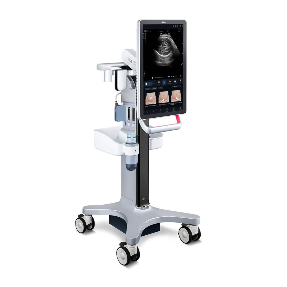 Acclarix GX9F – Système d’échographie intelligent pour l’obstétrique