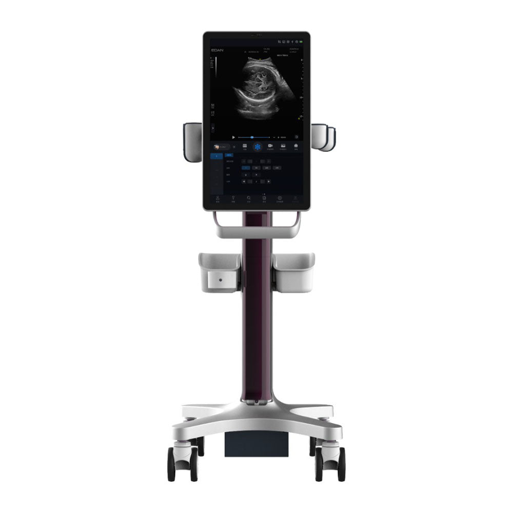 Acclarix GX9F – Système d’échographie intelligent pour l’obstétrique