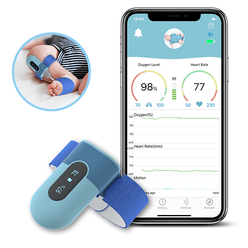 Moniteur des signes vitaux pour bébé - Baby O2