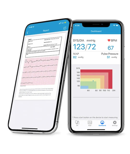 Tensiomètre bras électronique sans fil avec Wi-Fi - BP2 Connect