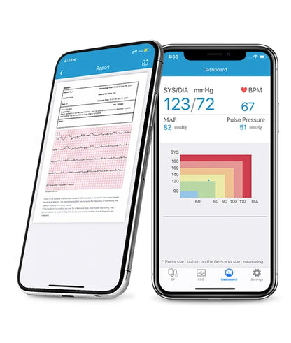 Tensiomètre bras électronique sans fil avec Wi-Fi - BP2 Connect